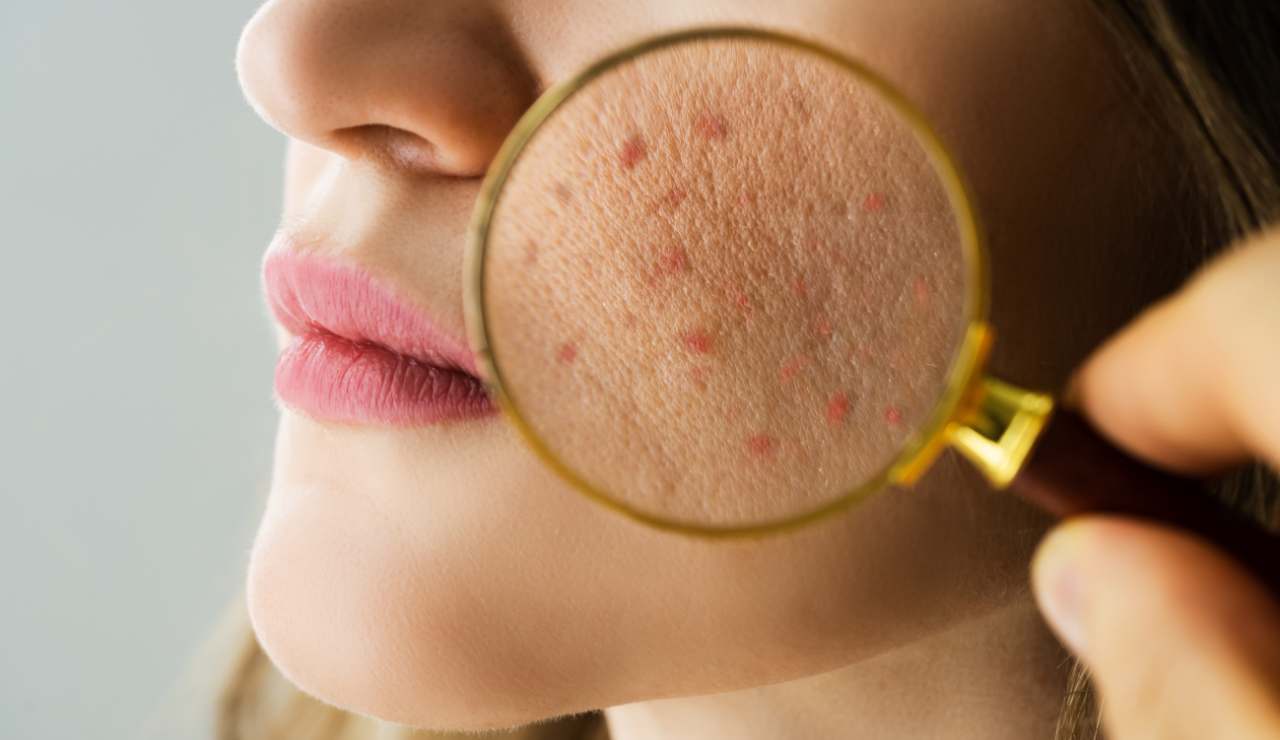 If your skin is like this, beware: You may be suffering from a nutritional deficiency
