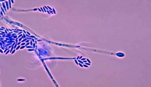 Fusarium verticillioides funghi contaminazione alimenti