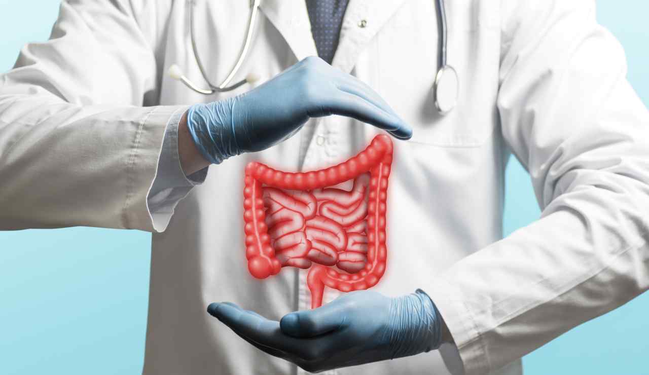 Intestino irritabile